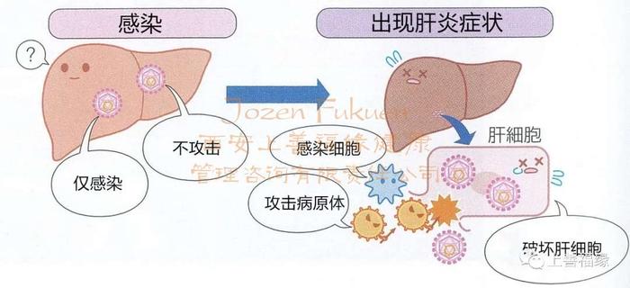 病毒性肝炎的發病機制*病毒性肝炎是由多種肝炎病毒引起,以肝臟病變為