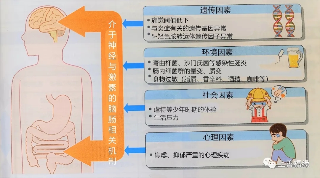 腸易激綜合症