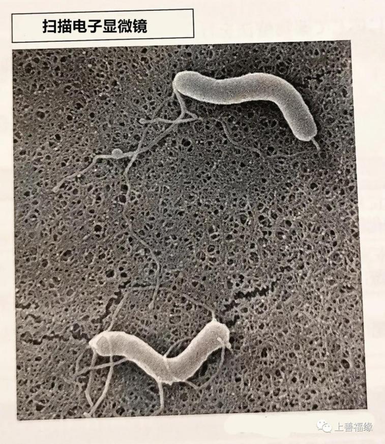 幽门螺旋杆菌放大图片图片