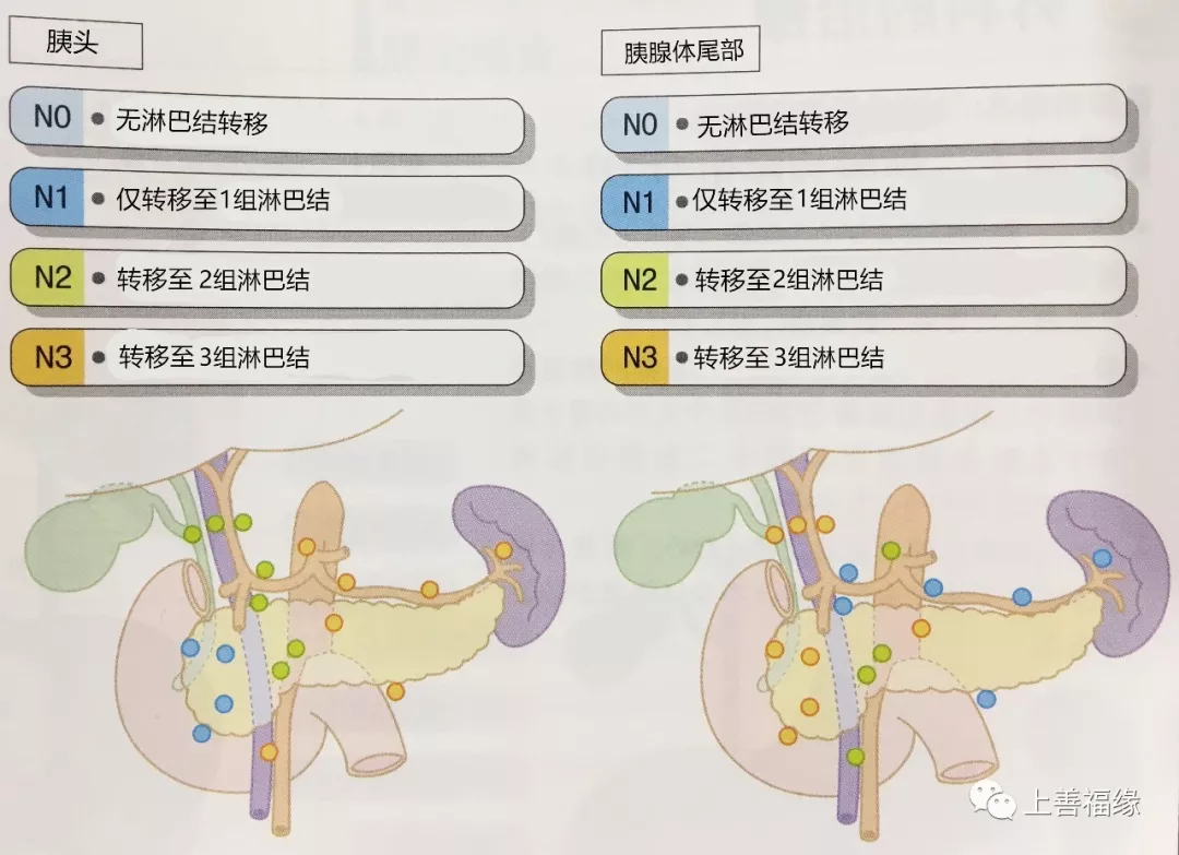 胰腺癌的诊断及治疗上