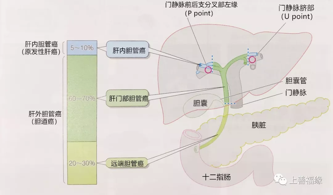 胆管癌1 我的网站